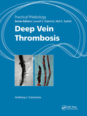 cover image of Practical Phlebology